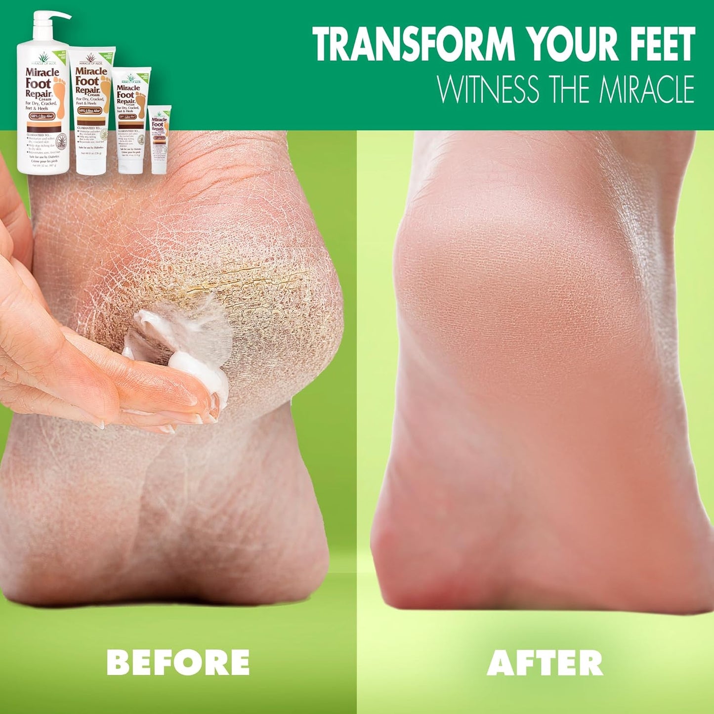 Miracle Foot Repair Cream, (1 oz / 3 Pack) Repairs Dry Cracked Heels and Feet, 60% Pure UltraAloe Moisturizes, Softens, and Repairs-Velvo Beauty