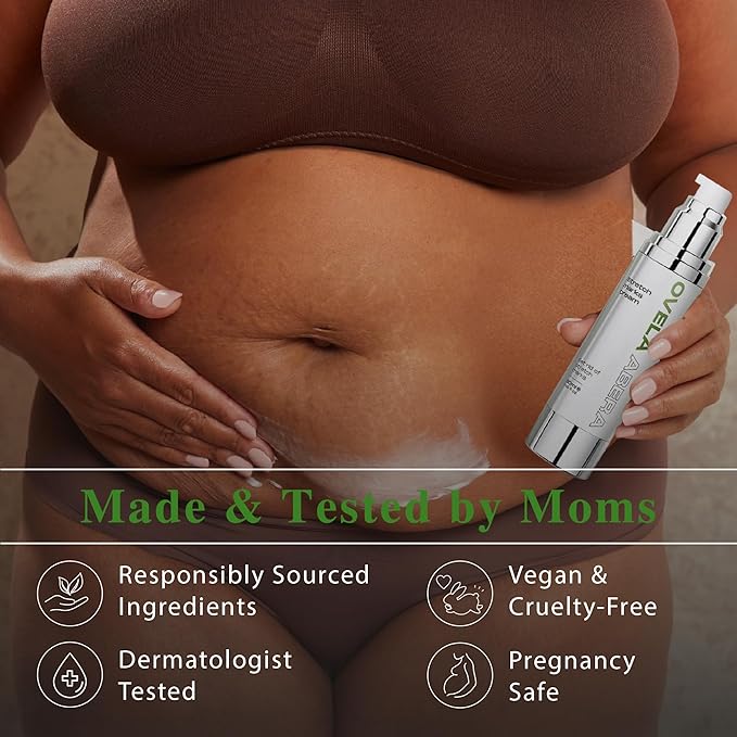 Abera Ovela Maternity Stretch Mark Cream for Pregnancy and Weight Fluctuations, Stretch Mark Treatment Pregnancy Must Haves, Deep Stretch Mark Removal, All Skin Types, 1.69 fl oz-Velvo Beauty