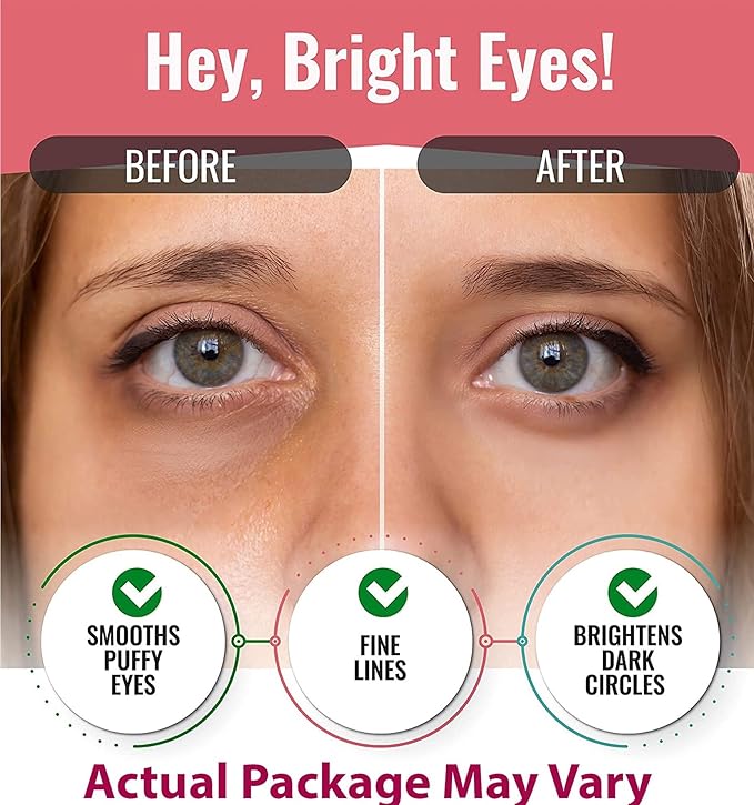 Eye Mask for Puffiness - Under Eye Patches for Dark Circles - Korean Under Eye Mask Patches for Puffy Eyes - Eye Gel Pads Depuffing Eye Brightener, Caffeine, Hydrogel & Collagen (20 Pairs)-Velvo Beauty