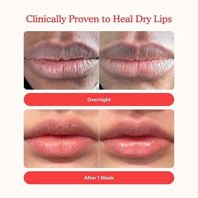 Tower 28 LipSoftie Hydrating Tinted Lip Treatment Balm, Moisturizing Lip Mask for Chapped Lips - Sugar Plum Flavor, Sheer Mauve-Velvo Beauty