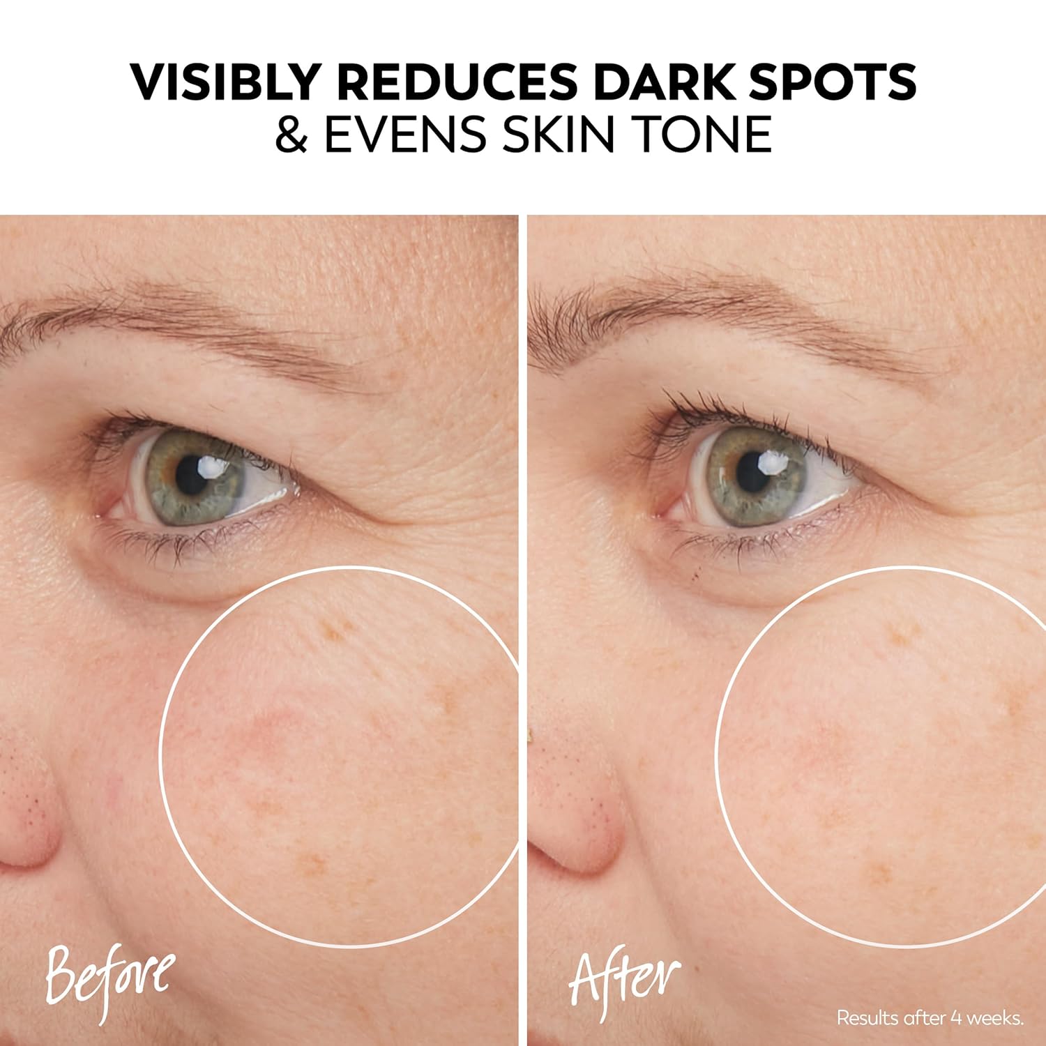 Olay Pro-X Dermatological Even Skin Tone Spot Fading Treatment Serum, 1.3 oz-Velvo Beauty