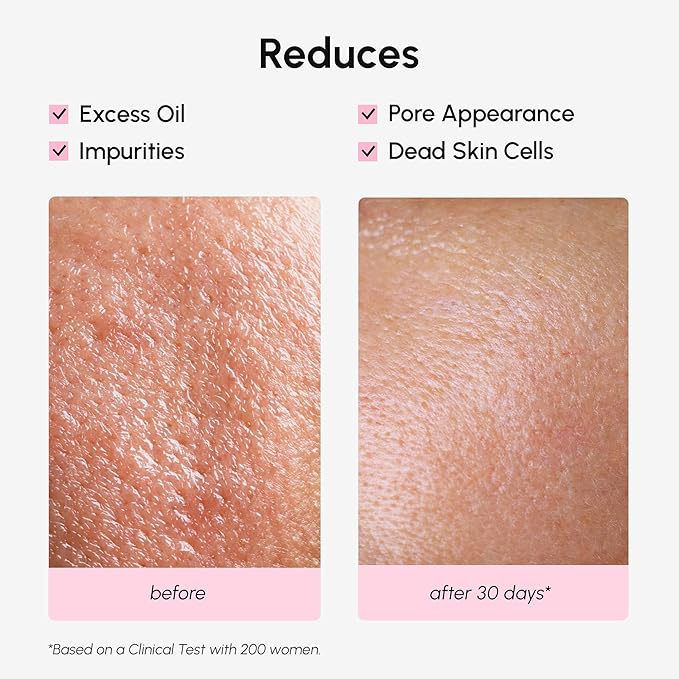 MAREE Pore Minimizer for Face Toner – Oil Control Facial Toner with Niacinamide, Witch Hazel & Marine Collagen – Gentle Exfoliating Face Toner for Women – Oily, Normal, Sensitive Skin – Tonico Facial-Velvo Beauty