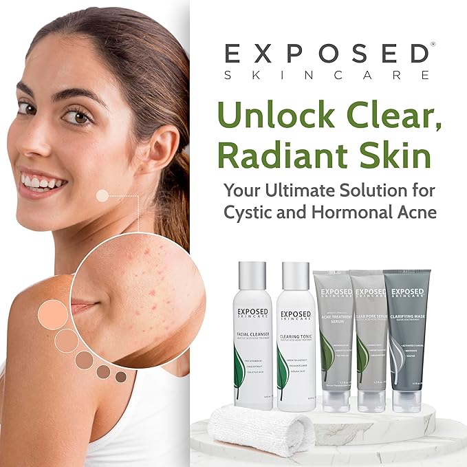 Exposed Skin Care Acne Treatment Kit - Includes Facial Cleanser, Clearing Tonic, Acne Treatment Serum, Clear Pore Serum, Clarifying Mask, Cloth - Natural Acne Solution for Face, All Ages & Skin Types-Velvo Beauty