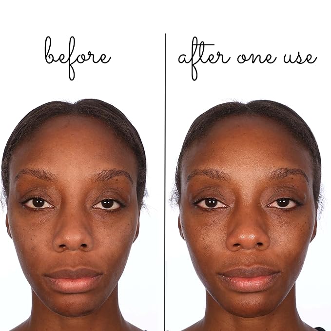 Consult Beaute Volumagen Miracle Plumping Barrier Balm - Facial Moisture Slugging - Overnight Deep Skin Hydration - Dry Skin - Hyaluronic Acid - Petrolatum Free - Lanolin Free - Mineral Oil Free 1 oz-Velvo Beauty