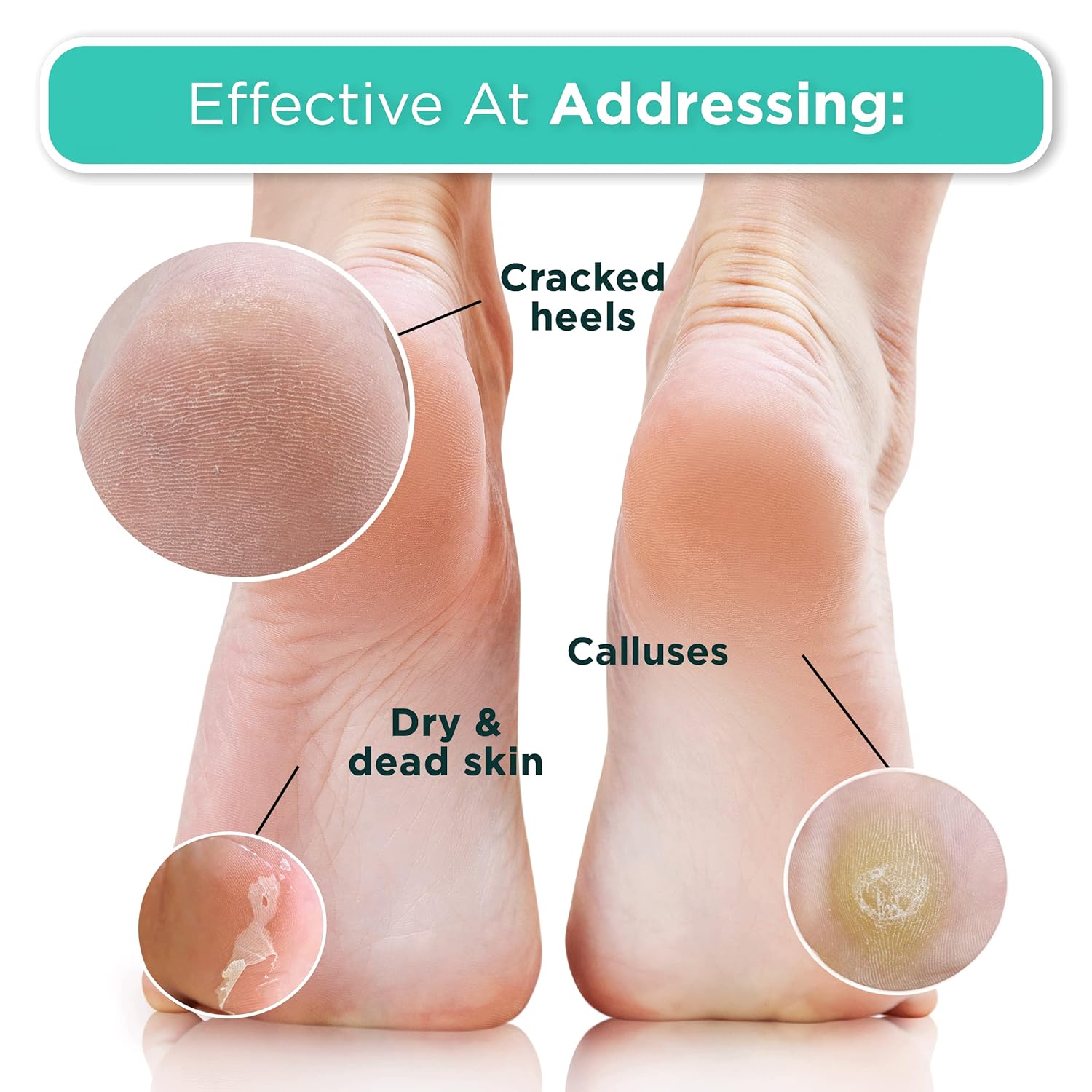 DERMORA Foot Peel Mask - 2 Pack of Regular Size Skin Exfoliating Foot Masks for Dry, Cracked Feet, Callus, Dead Skin Remover for Baby Soft Feet, Lavender Scent-Velvo Beauty