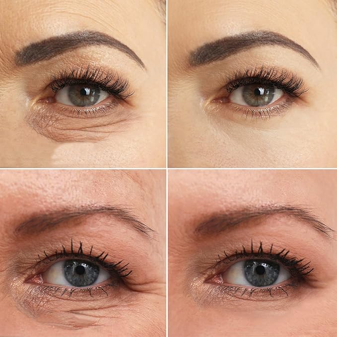 Pdo Lifting Thread, Pdo Threads Lift for Eyes, Helps Restore Skin's Firmness and Elasticity, and Improves Eye Wrinkles (20PCS-30G*25MM)-Velvo Beauty