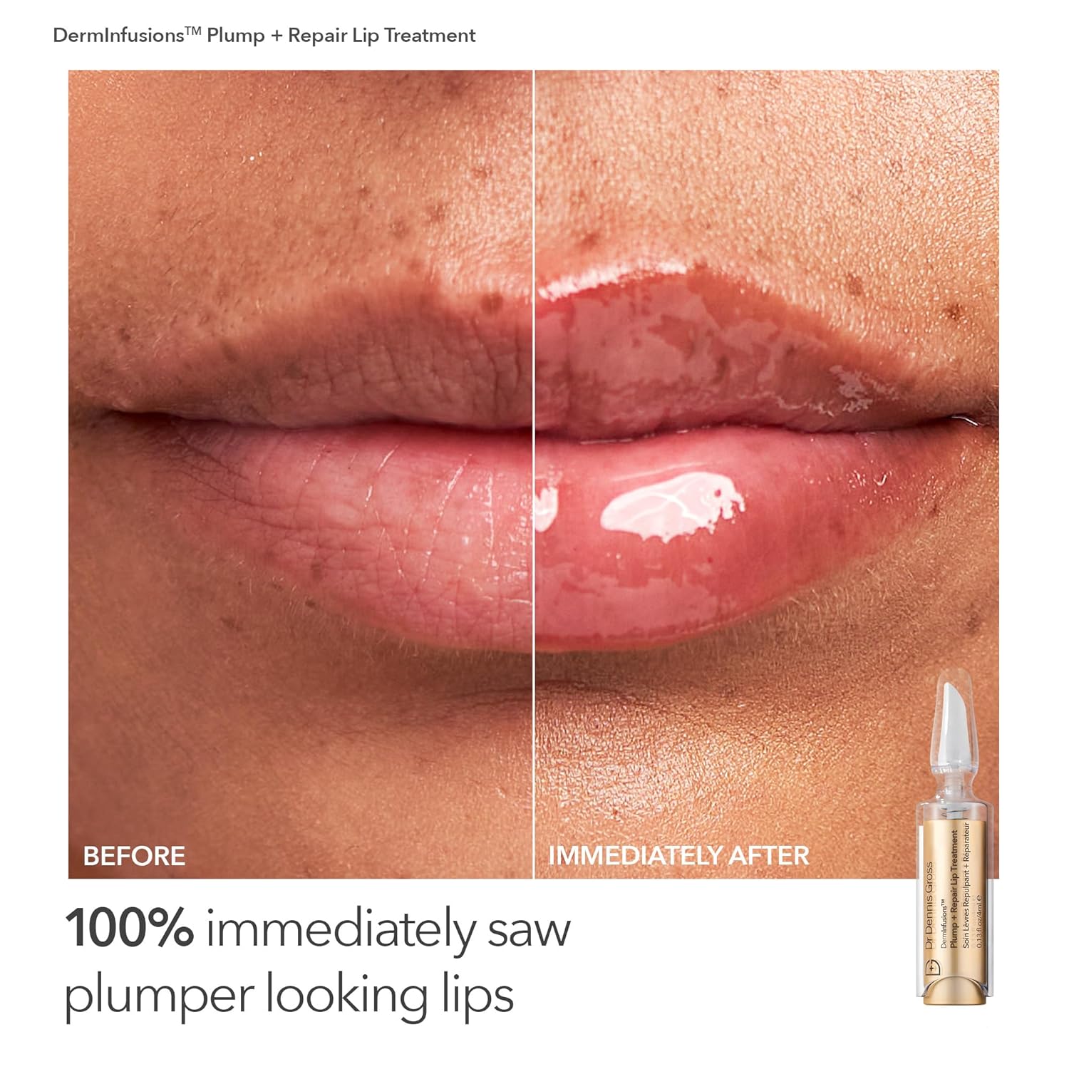 Dr. Dennis Gross Fill, Plump & Firm Kit – DermInfusions™ Hyaluronic Acid Serum, Eye Cream & Lip Treatment | Boost Hydration, Smooth Fine Lines & Enhance Volume | Limited Edition Gift Set-Velvo Beauty