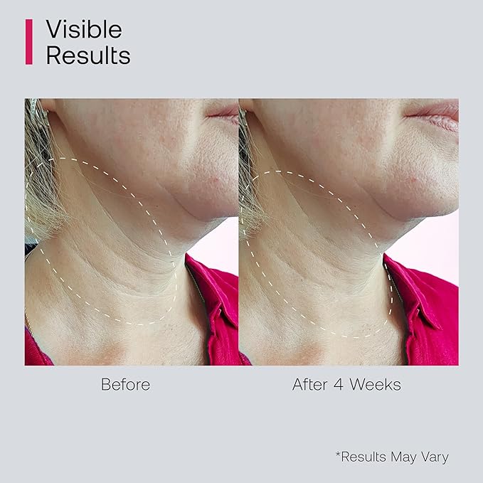 Retinol Neck Firming Cream with Cooling & Massaging Roller Applicator - Hydrates, Lifts, Smoothes Wrinkles, Fine Lines & Tightens Sagging Skin with Niacinamide & Hyaluronic Acid, 1.7oz/50g-Velvo Beauty