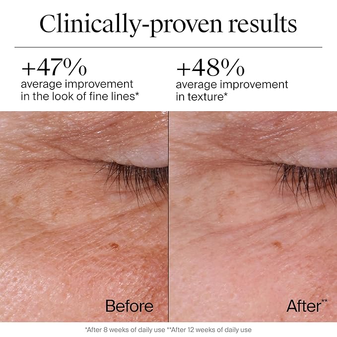 Neutrogena Rapid Wrinkle Repair Retinol Face Moisturizer, Daily Anti-Aging Face Cream with Retinol & Hyaluronic Acid to Fight Fine Lines, Wrinkles, & Dark Spots, 1.7 oz-Velvo Beauty