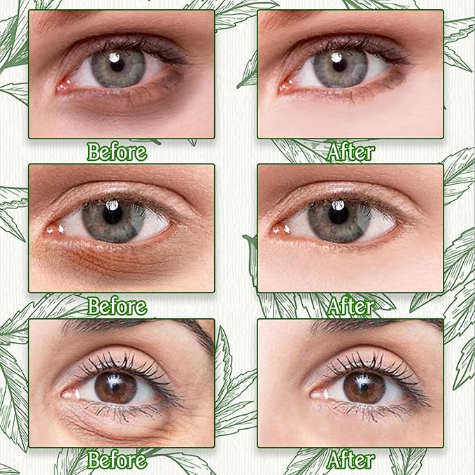 Under Eye Patches for Dark Circles and Puffiness, 60 Pcs Green Tea Collagen Eye Mask, Hydrating Eye Patches for Puffy Eyes Wrinkle Treatment, Eye Gel Pads Self Eye Skin Care Gifts for Women-Velvo Beauty