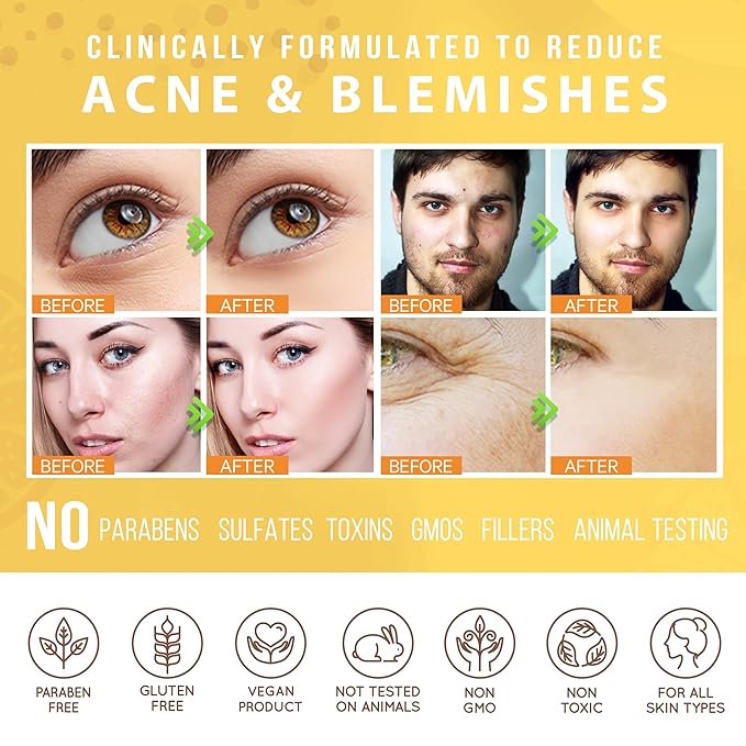 LILY SADO HONEY WALNUT Creamy Face Scrub - Best Exfoliating Facial Cleanser for Women & Men - Gently Exfoliates, Softens & Energizes Skin, Treats Acne, Reduces Pore Size - For All Skin Types - 4 oz-Velvo Beauty