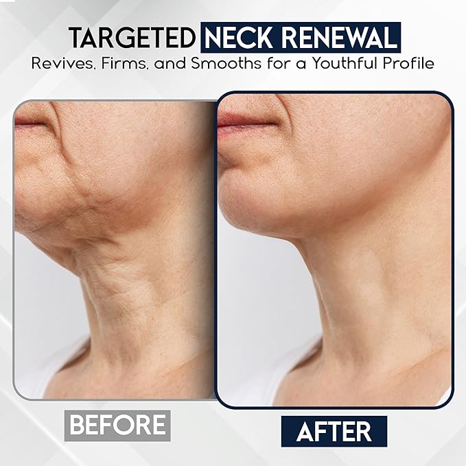 Neck Creams for Tightening and Firming Sagging Skin - Skin Tightening Cream for Face - Decollete & Chest, Under Chin Firming for Older Women - Neck Wrinkles Treatment with Collagen & Hyaluronic Acid-Velvo Beauty