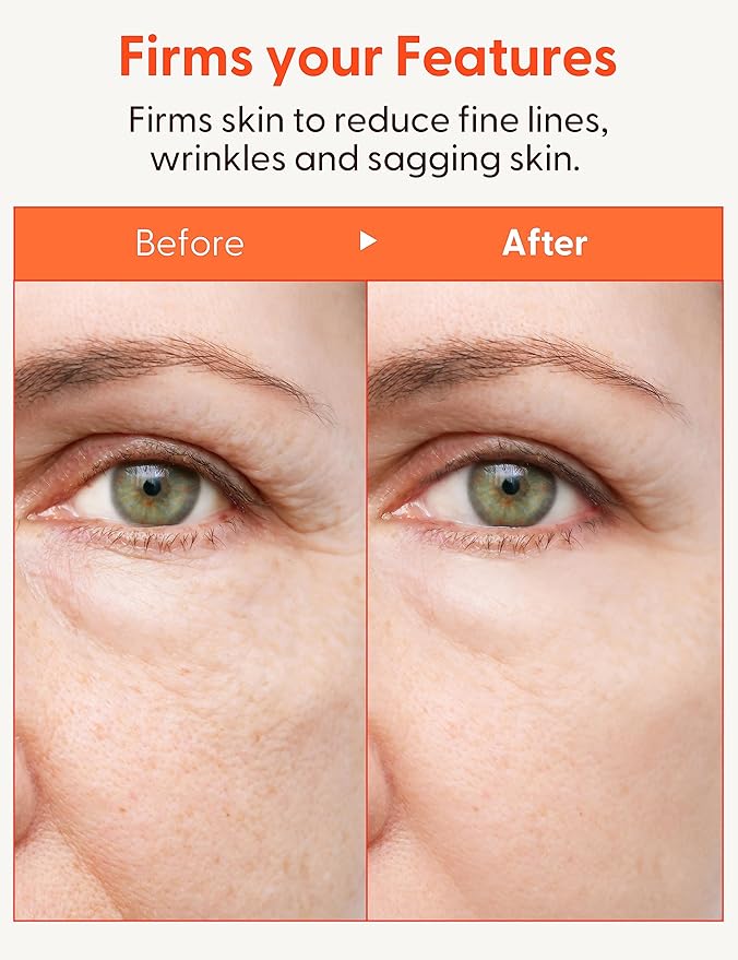 It'S SKIN Collagen Nutrition Emulsion - Marine Collagen Volume & Firming Facial Lotion, Intense Revitalizing & Elasticity for Rough and Aging Skin, 5.07 fl.oz.-Velvo Beauty