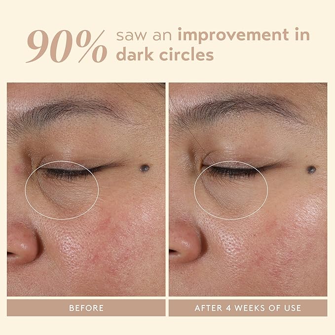 SHANI DARDEN Intensive Eye Renewal Cream, Hydrating Under Eye Cream for Dark Circles, Fine Lines, Wrinkles & Crows Feet with Niacinamide, Shea Butter & Ceramide, Crease-Free & Makeup-Ready, 0.50 fl oz-Velvo Beauty
