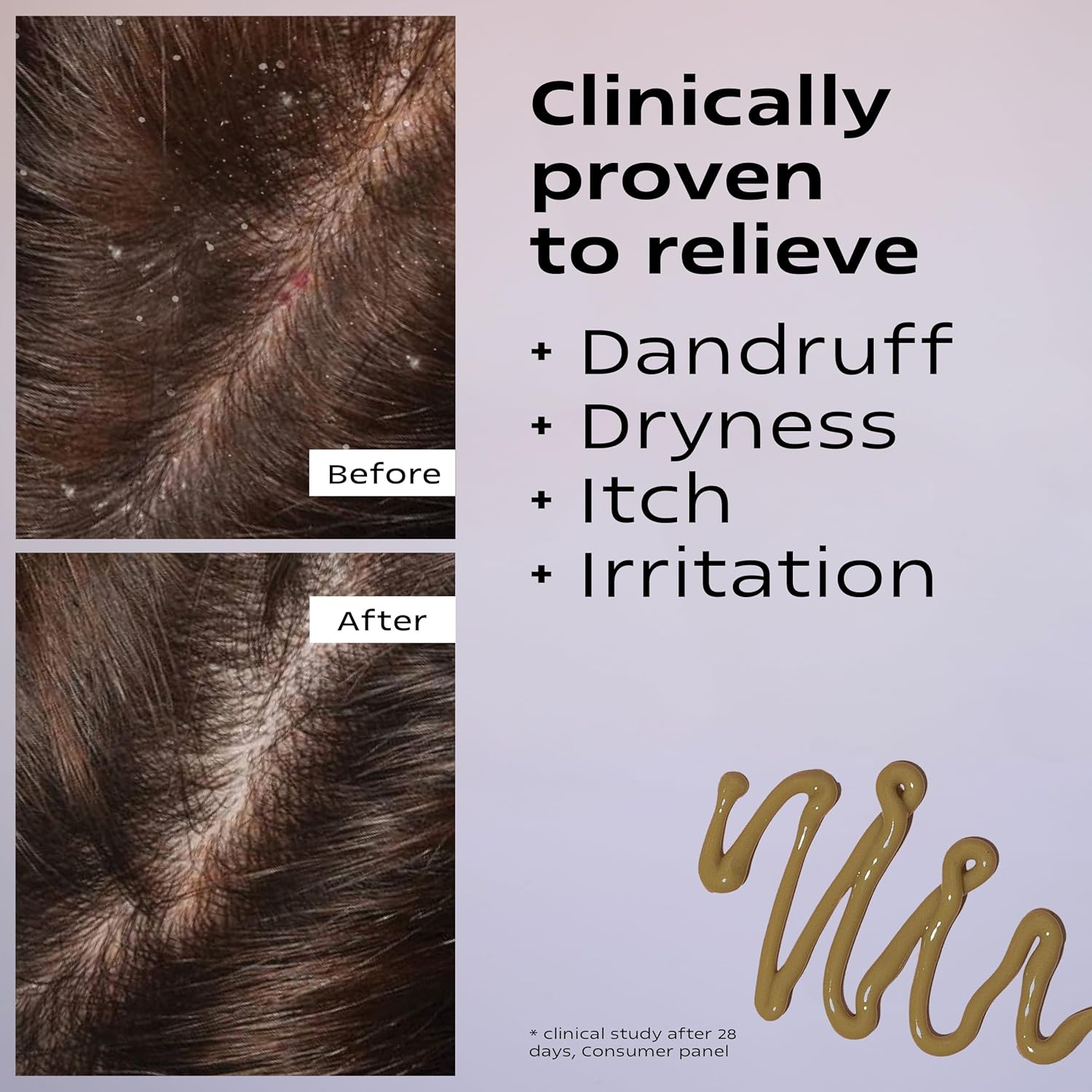 KAMEDIS Scalp Moisturizer Lotion For Dry, Itchy, Dandruff, Flaky, Seborrheic Dermatitis, Psoriasis and Sensitive Scalp. Over-Night Mask Treatment Botanicals-Based. Parabens Free. 3.38 Fl Oz.-Velvo Beauty