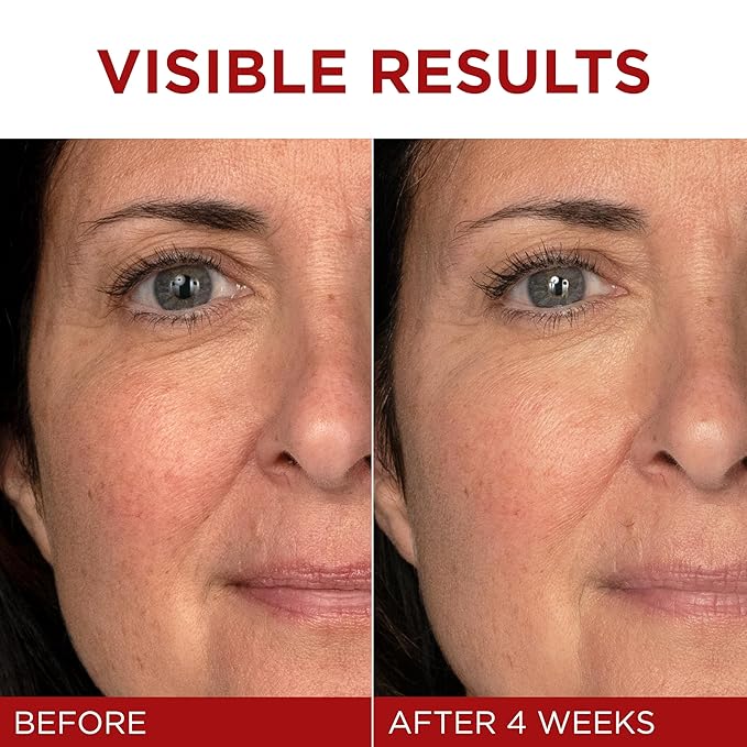 L'Oreal Paris Revitalift Triple Power Anti-Aging Face Moisturizer, Pro Retinol, Hyaluronic Acid & Vitamin C, Reduce Wrinkles 2.55 Oz-Velvo Beauty