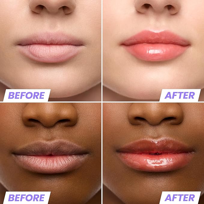 Wonderskin Lip Oil Rehab Serum - Tinted Lip Oil for Women, Hydrating, Moisturizing, and Non-Sticky Bright Red Tint Serum for Dry Lips (Flirt)-Velvo Beauty