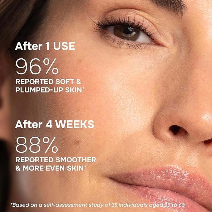 SimplyVital Moisturizer for Neck & Décolleté – With Collagen, Retinol, Peptides & Hyaluronic Acid – Anti-Aging Hydration – Made in USA – 1 fl.oz-Velvo Beauty