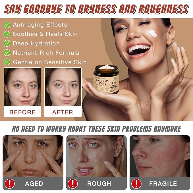 Beef Tallow for Skin,Tallow and Honey Balm,Beef Tallow for Face,Tallow Face Moisturizer,Natural Moisturizer Hydrates,Deeply Nourishes the Skin, Enhances Natural Radiance (1pcs)-Velvo Beauty