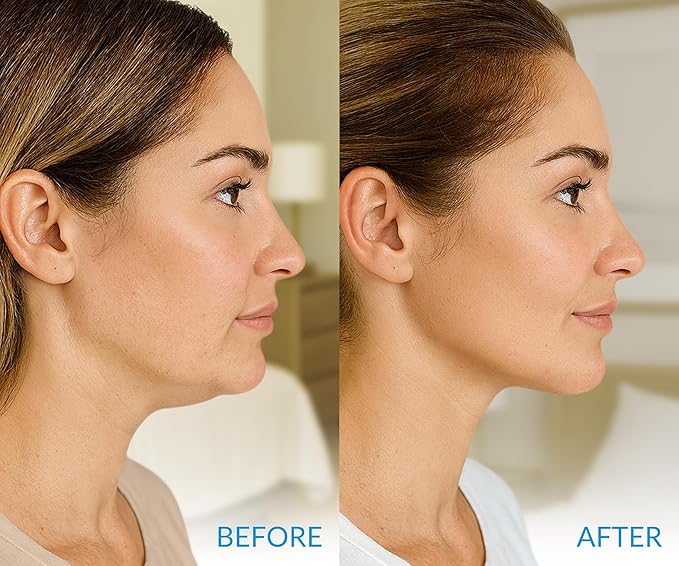 Stylia MaxiLift V-Line Lifting Collagen Face Mask – Enhanced Double Chin Reducer – Jawline Shaper Face Lifting Masks – Firming Neck Lift Collagen Mask – Chin Strap for Sleeping – Hyaluronic, Aloe 10PC-Velvo Beauty