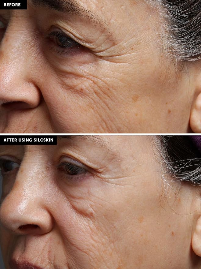 SilcSkin Full Face Set, Helps with Face & Brow Wrinkles from Sun Aging Side Sleeping, Reusable Self Adhesive Medical Grade Silicone, 1 Brow Pad, 4 Eye Pads, 2 Multi-Area Pads - 45 Day Supply-Velvo Beauty