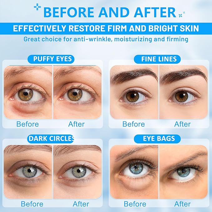 Under Eye Patches for Puffy Eyes: 30 Pairs Retinol Collagen Eye Gels Pads - Reduce Wrinkles, Puffy Eyes, Eye Bags - Skin Treatment Mask with Retinol Collagen - Anti Aging & Face Moisturizer-Velvo Beauty