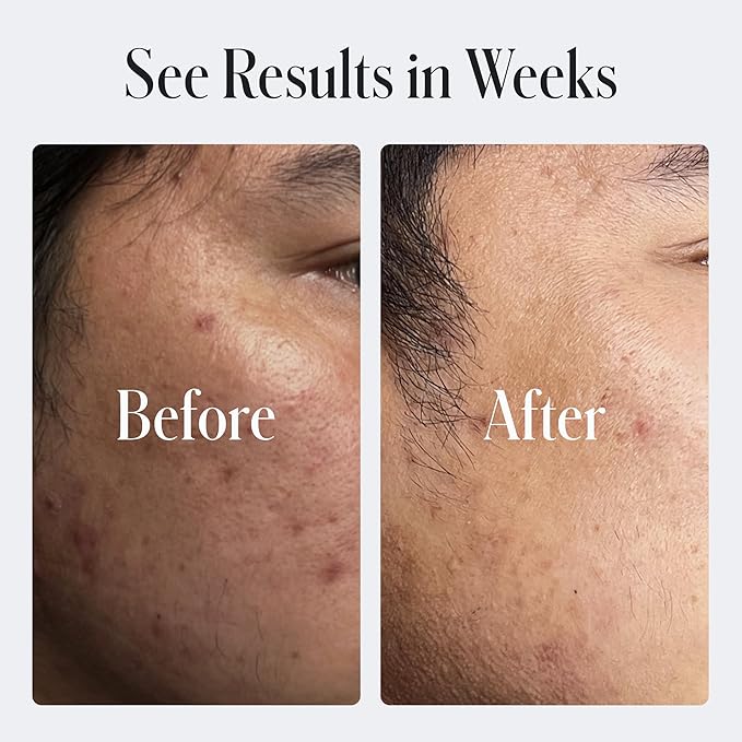 Geologie Skin Repair Moisturizer Face Cream | Clear System Retinol Resurfacing Formula | For Blemish Prone Skin with Niacinamide & Hyaluronic Acid | 60 ML-Velvo Beauty