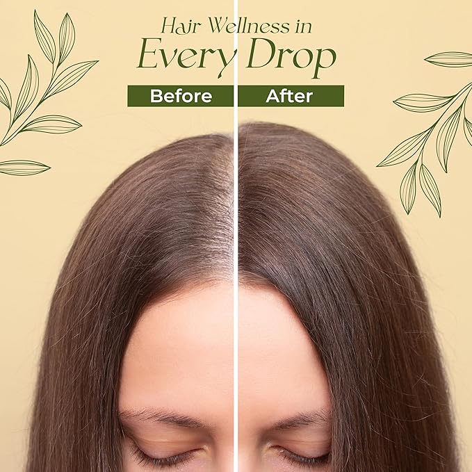 Natural Hair Growth Oil for Women infused with 10 Premium Botanic Oils plus Organic Rosemary Oil for Hair Growth | Salon-Grade Volumizing & Nourishment | Non-GMO Verified | 30-Day Supply-Velvo Beauty