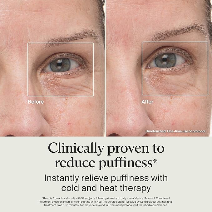 Therabody TheraFace Depuffing Wand – Cold and Heat Skincare Treatment to Depuff and Glow; Beauty Wand, Face Roller and Eye Massager for Eye Puffiness, Dark Circles and Skin Radiance (White)-Velvo Beauty