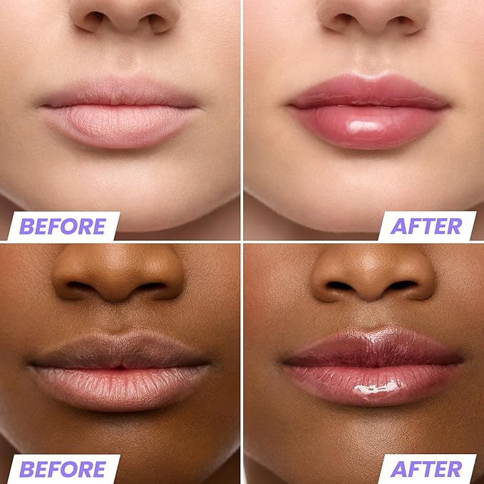 Wonderskin Lip Oil Rehab Serum - Tinted Lip Oil, Hydrating, Moisturizing, and Non-Sticky Deep Red Tint Serum for Dry Lips (Honey)-Velvo Beauty