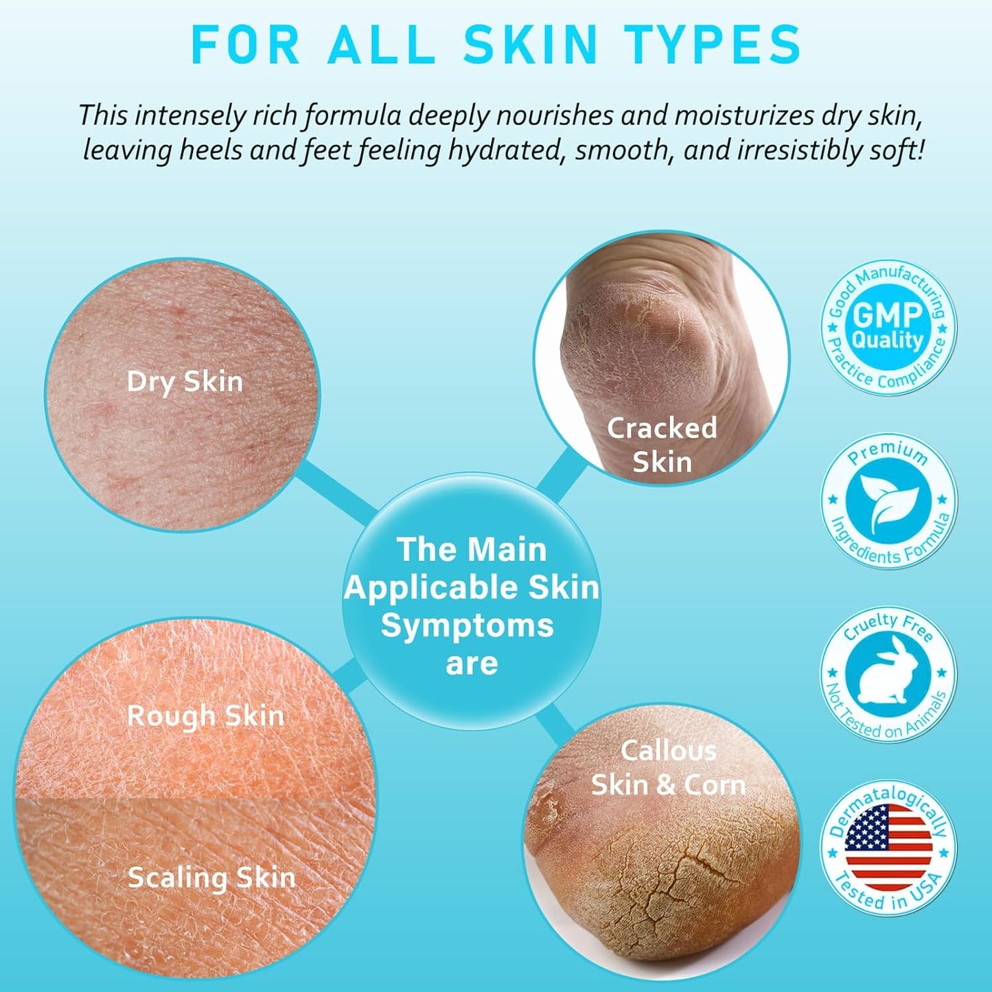 Urea Cream 40 Percent For Feet Maximum Strength - plus Salicylic Acid 2% Foot Cream For Dry Cracked Heels Feet Knees - Dead Skin Cuticle Callus Remover Toenail Softener-Velvo Beauty