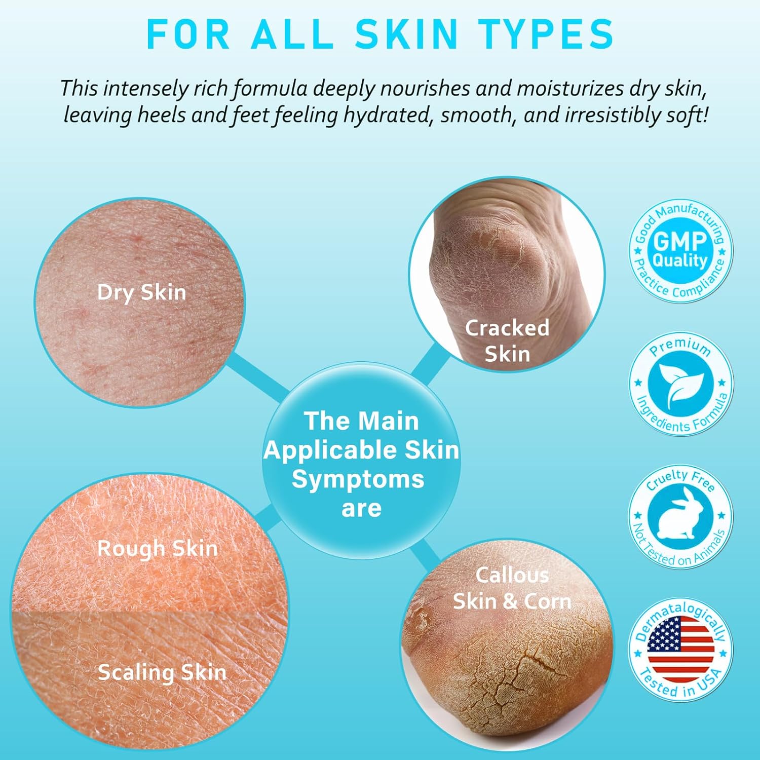 Urea Cream 40 Percent For Feet Maximum Strength - plus Salicylic Acid 2% Foot Cream For Dry Cracked Heels Feet Knees - Dead Skin Cuticle Callus Remover Toenail Softener-Velvo Beauty