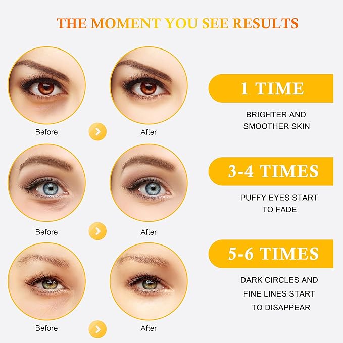 Under Eye Patches for Puffy Eyes, Hot Cold Treatment Cooling Gel Eye Pads Eye Mask for Wrinkles Dark Circles Puffiness Eye Bags，Eye Ice Pack， 6Pair-Velvo Beauty