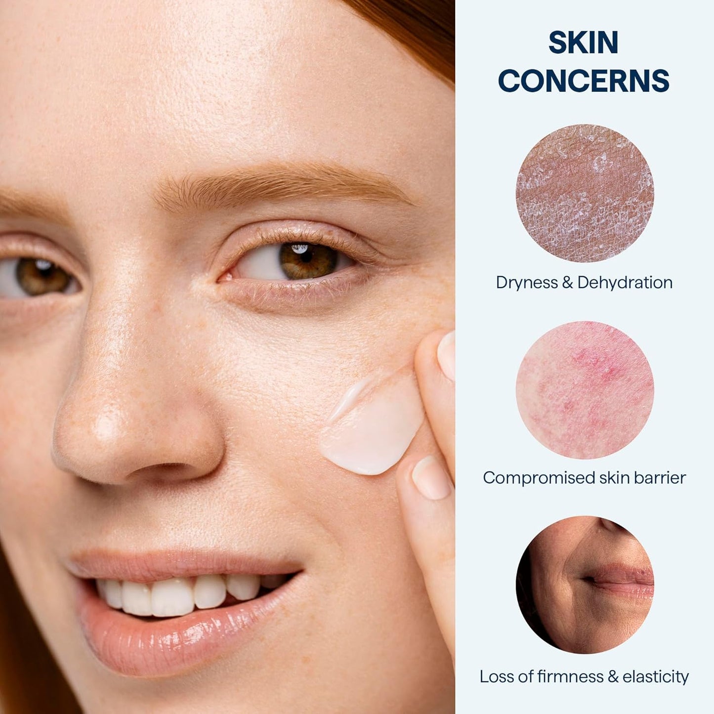 Remedy for Rich Moisture - Barrier Repairing Rich Cream Moisturizer for Normal to Dry Skin - Quadruple Ceramide Complex, Peptides, Squalane, Glycerin- By Dermatologist Dr. Shah, 1.7 fl. oz-Velvo Beauty