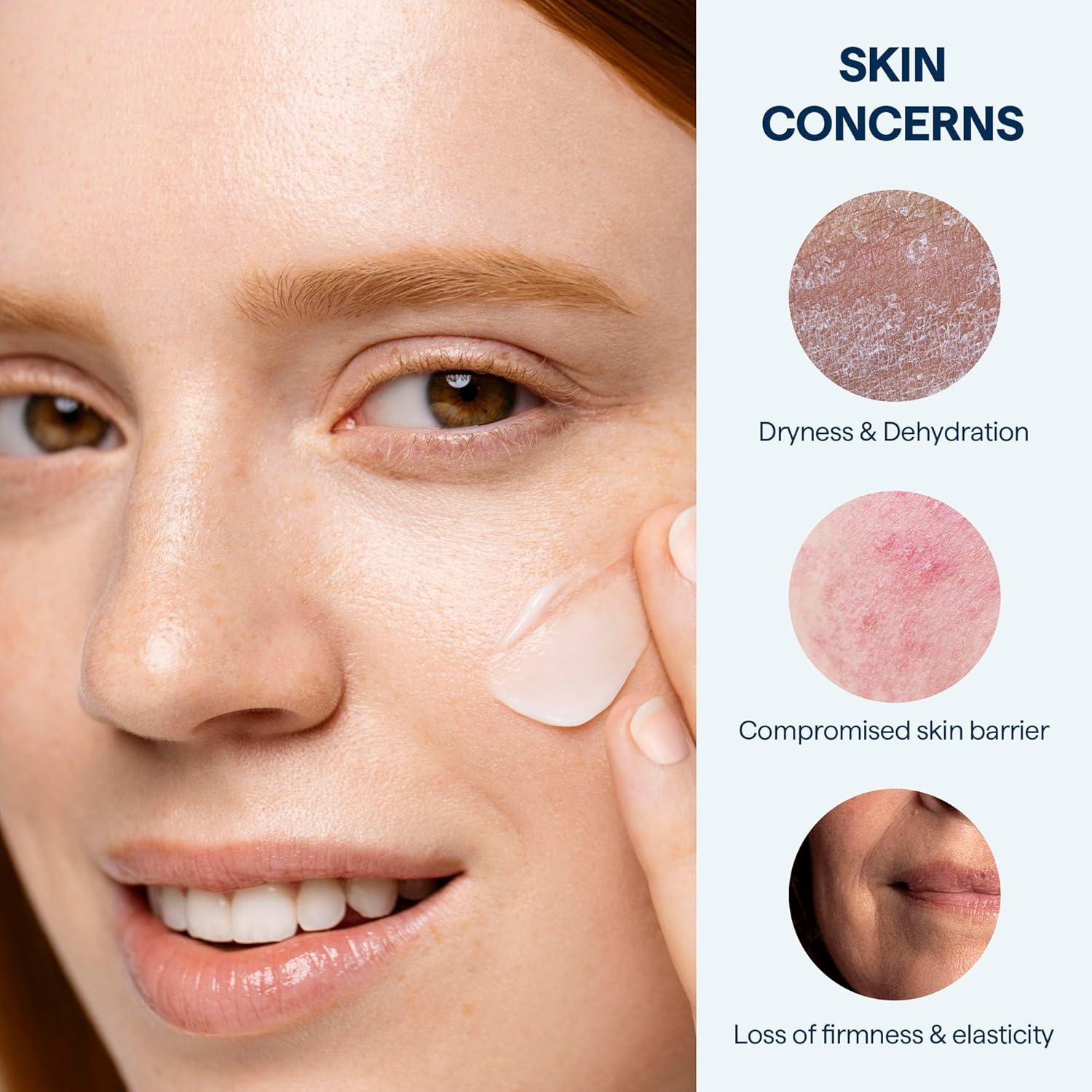 Remedy for Rich Moisture - Barrier Repairing Rich Cream Moisturizer for Normal to Dry Skin - Quadruple Ceramide Complex, Peptides, Squalane, Glycerin- By Dermatologist Dr. Shah, 1.7 fl. oz-Velvo Beauty