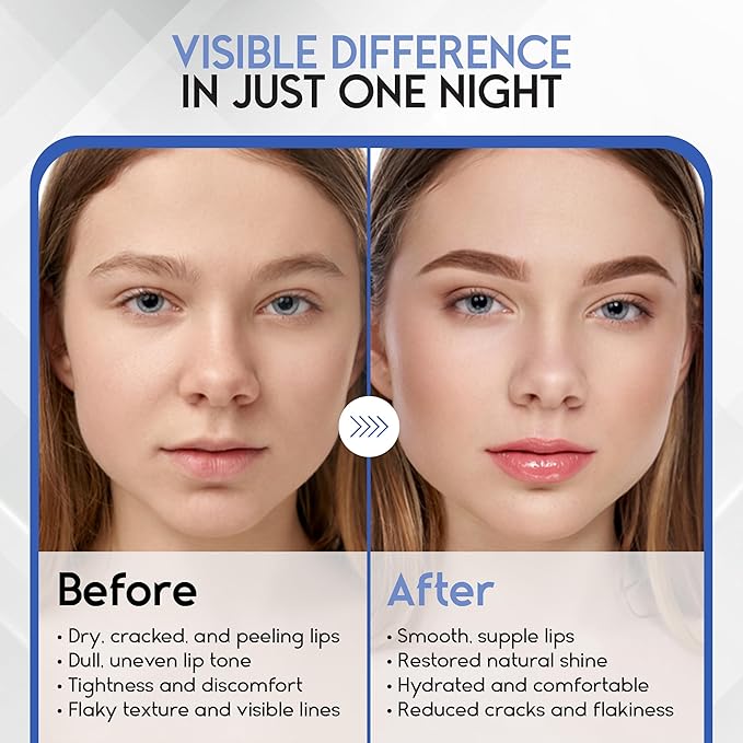 Lip Mask Overnight with Hyaluronic Acid & Collagen, Lip Sleeping Mask for Dry Cracked Lips, Moisturizing, Hydrating, Exfoliating Night Treatment for Lip Care (Berry)-Velvo Beauty