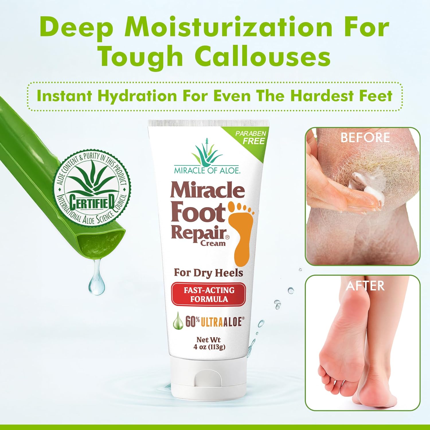 Aloe Vera Lotion & Foot Cream Combo – Aloe All Over 1 oz + Foot Repair 4 oz – Soothing Aloe Lotion for Dry Skin, Hands, Heels & Body – Diabetic-Safe Foot Cream for Cracked Feet-Velvo Beauty