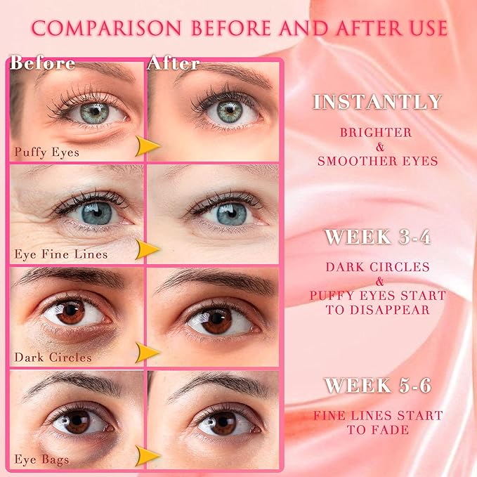 Pink Rose Eye Mask– 60 Pcs - Gold Under Eye Mask Retinol & Collagen - Puffy Eyes and Dark Circles Treatments – Look Younger and Reduce Wrinkles and Fine Lines Undereye, Improve and Firm eye-Velvo Beauty