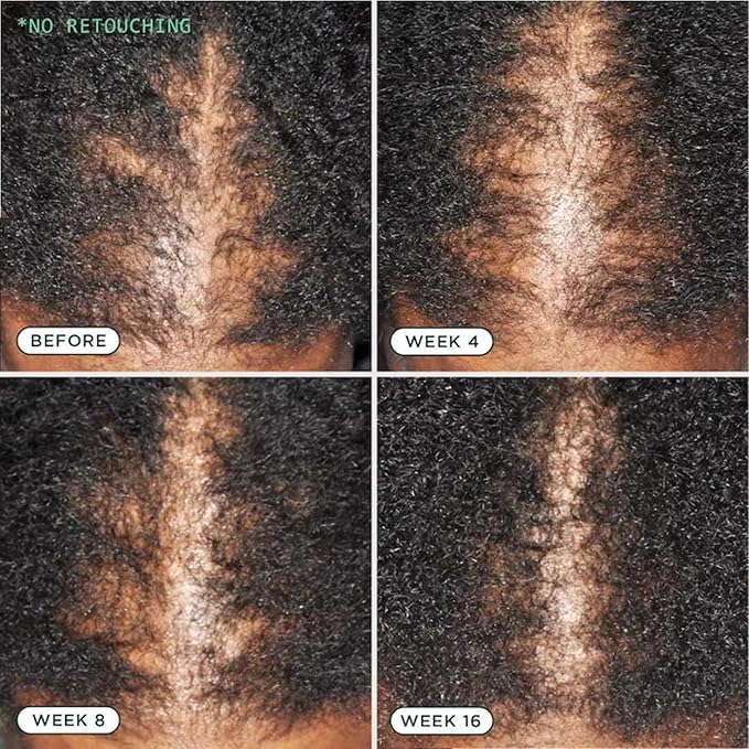 Sienna Naturals - D.N.A. Scalp Serum – Hair Growth Serum for Thinning Hair, Scalp Repair & Strength – Nourishing, Active Treatment for Scalp Health with Biotin & Rosemary– 1 oz-Velvo Beauty