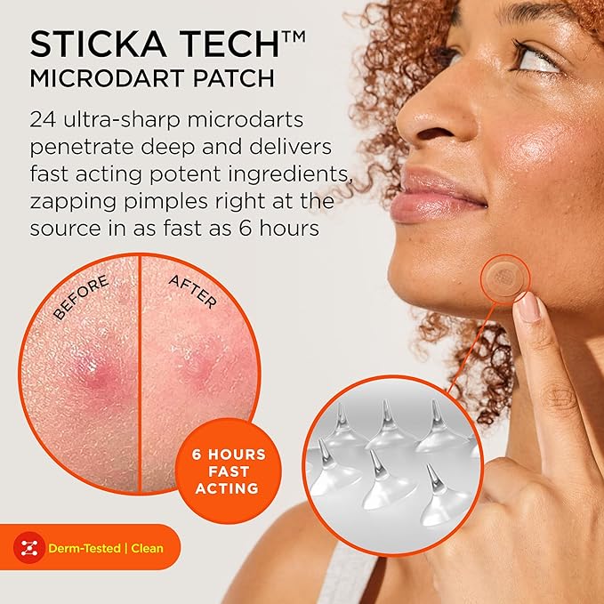 ZitSticka Killa Pimple Patches for Face - World's Most Potent Pimple Patch with Fast-Acting Microdarts - Starts Working within 6 Hours for Deep, Early-Stage Zits - Regular 8 Count with Cleana Swab-Velvo Beauty