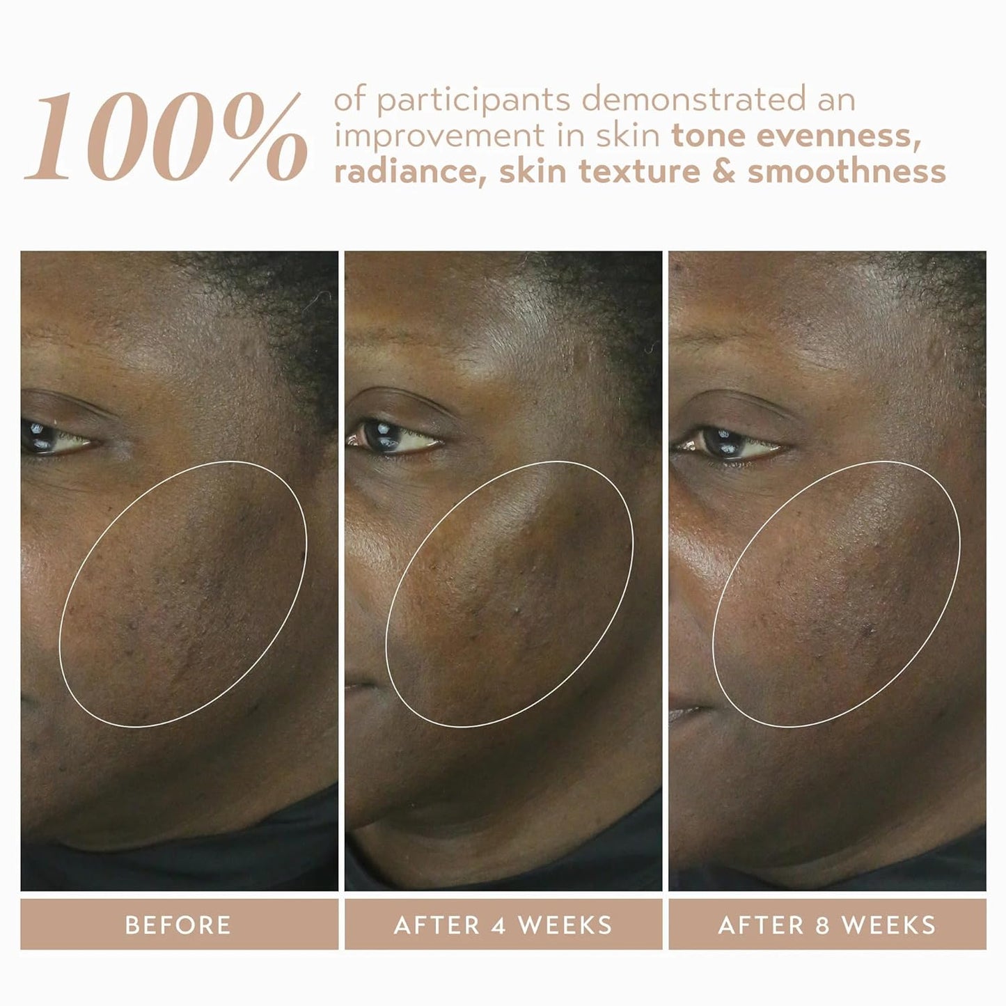 SHANI DARDEN SKIN CARE Retinol Reform with 1% Encapsulated Retinol Serum for Face & Neck, Gentle Slow-Release Face Serum with Tripeptide for Wrinkles, Fine Lines & Uneven Tone, 1 fl oz-Velvo Beauty