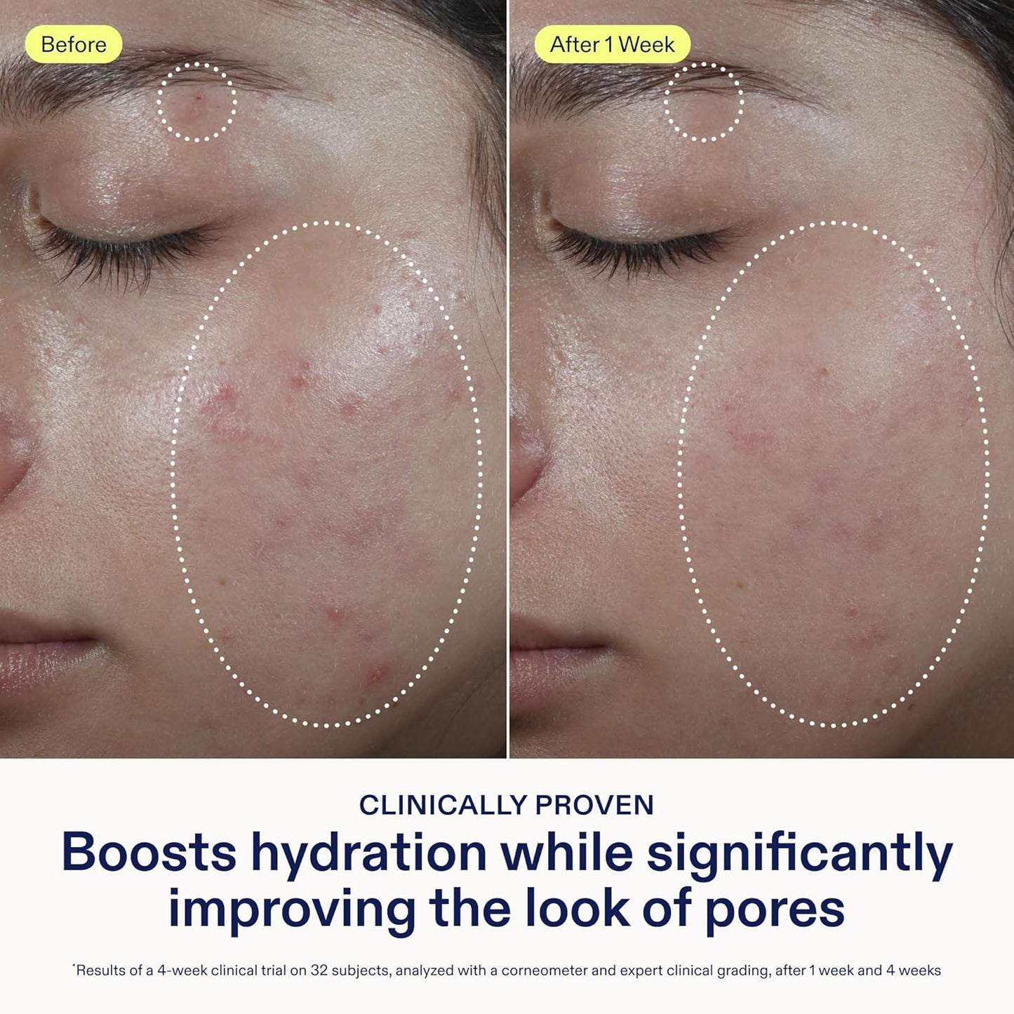 Skinfix Barrier Balancing Water Cream - 1.7 oz - Fast-Absorbing, Weightless Moisturizer for Combo + Oily Skin - Acne-Safe, Non-Pore-Clogging - Non-Comedogenic - Fragrance Free - Vegan, Cruelty Free-Velvo Beauty