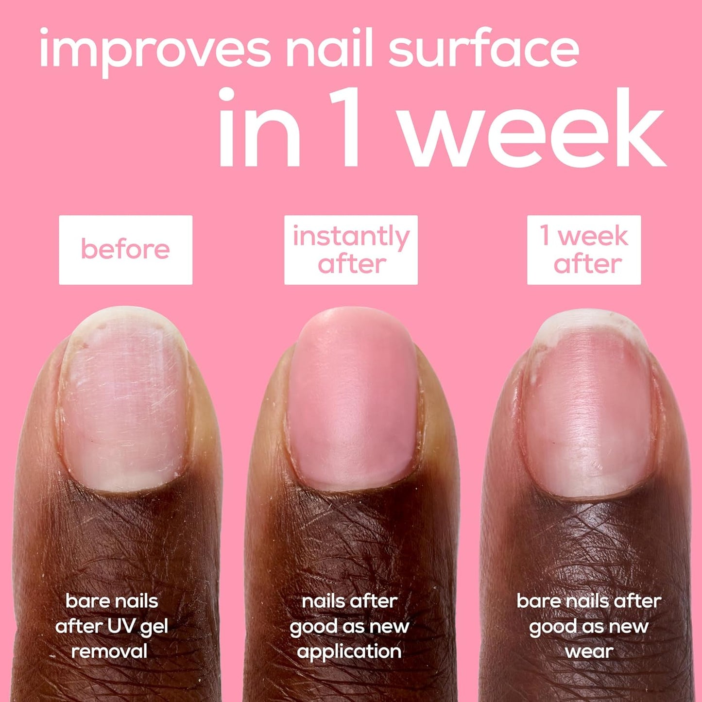 essie Nail Care, Ceramide-Infused Nail Treatment, Vegan, Good As New Concealer & Perfector, 0.46 Fl Oz-Velvo Beauty