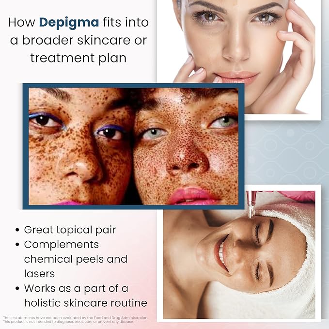 GlocalCare Depigma Support Reduction of Hyperpigmentation, Melasma & Dark Spots with Glutathione, Polypodium Leucotomos, Grape Seed & Marigold Extract-Velvo Beauty