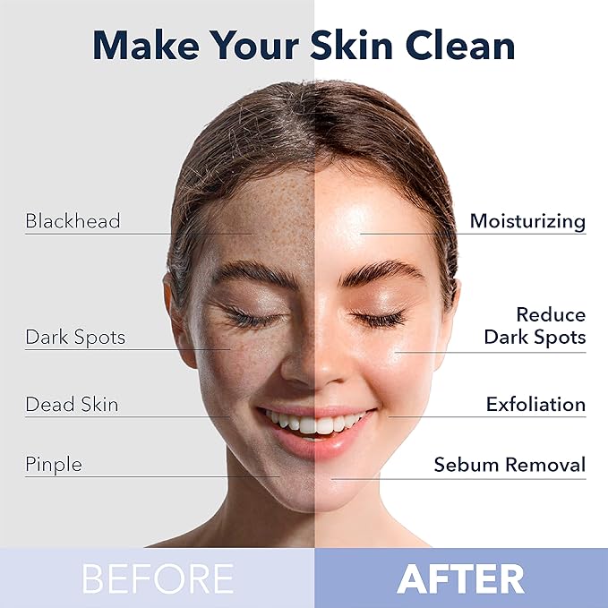 Purederm Deep Purifying Pink O2 Bubble Mask Peach (5 Pack) – Bubble Face Sheet Mask for Purifying & Moisturizing-Velvo Beauty