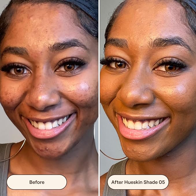 Live Tinted Hueskin Serum Concealer - Medium-to-Full Coverage Concealer with Niacinamide, & Hyaluronic Acid for Dark Circles, Fine Lines & Wrinkles, Buildable Long-Lasting Formula, 0.35 oz - Shade 5-Velvo Beauty