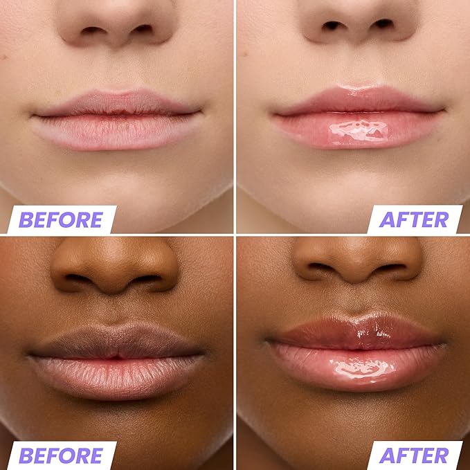 Wonderskin Lip Oil Rehab Serum - Tinted Lip Oil, Hydrating, Moisturizing, and Non-Sticky Coral Pink Tint Serum for Dry Lips (Lover)-Velvo Beauty