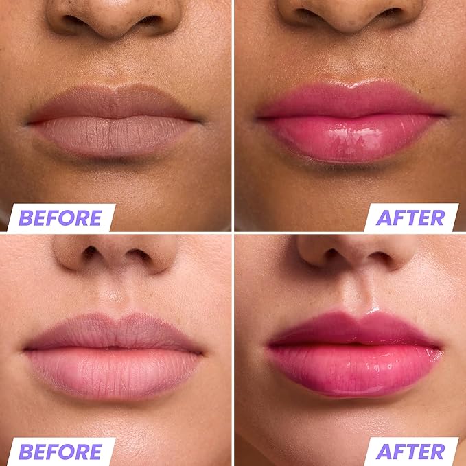 Wonderskin Lip Oil Rehab Serum - Color Changing Lip Oil from Clear to Pink - PH-activated, Non-sticky & Hydrating Tinted Serum for Dry Lips (Kissed)-Velvo Beauty