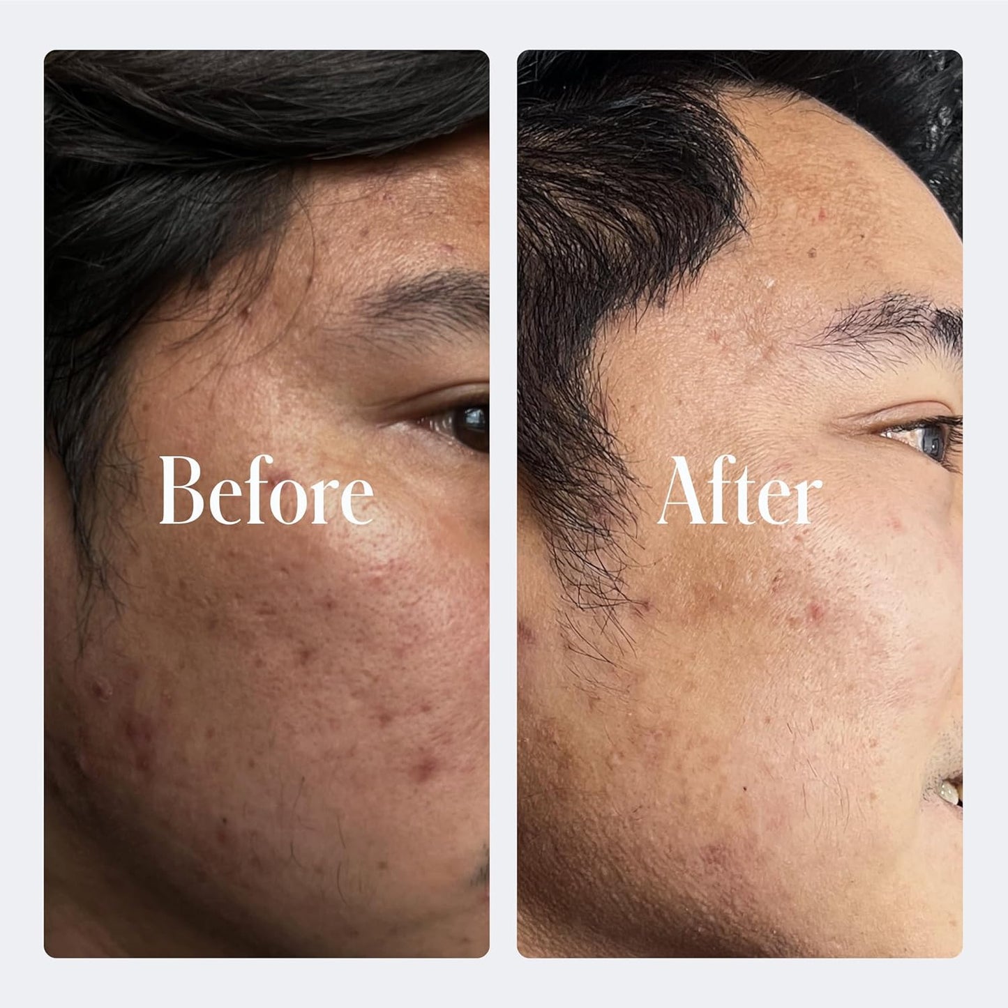 Geologie Retinol Anti-Aging Face Cream | Advanced .3% Retinol Formula for Effective Results | Reduce Fine Lines & Wrinkles | Protect & Repair Skin With Hyaluronic Acid & Niacinamide | For Men & Women-Velvo Beauty