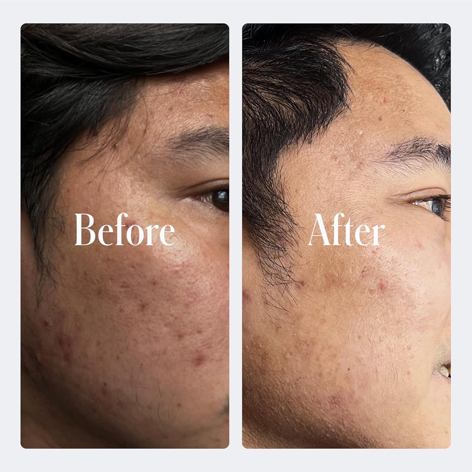 Geologie Retinol Anti-Aging Face Cream | Advanced .3% Retinol Formula for Effective Results | Reduce Fine Lines & Wrinkles | Protect & Repair Skin With Hyaluronic Acid & Niacinamide | For Men & Women-Velvo Beauty